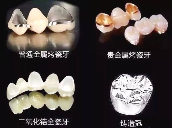 常德美奧口腔鉅惠看牙,韓國登騰種植牙3980元起,自鎖托槽矯正享5折優(yōu)惠！