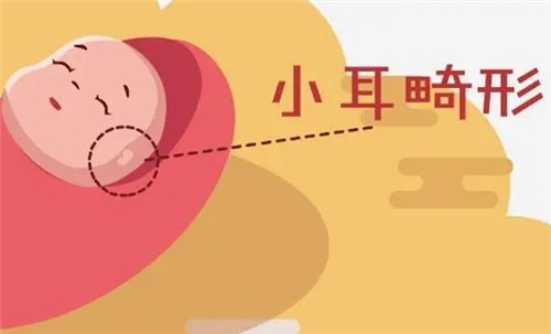 【河南中醫(yī)藥大學(xué)一附院】莊洪興教授暑假坐診，耳畸形修復(fù)限時(shí)預(yù)約！