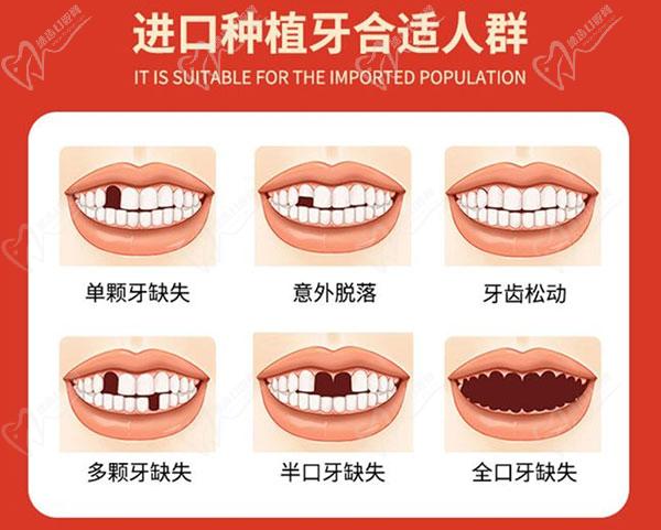 廣州穗江口腔醫(yī)院