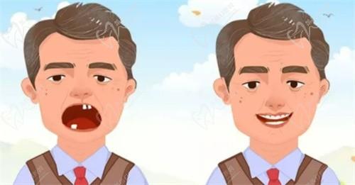 別等了！徐州邳州牙衛(wèi)士口腔進(jìn)口種植牙2980起,種兩顆送一顆,單顆滿(mǎn)3000減500超劃算！